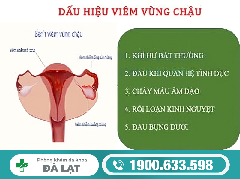 Hình ảnh minh họa